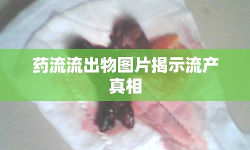 藥流流出物圖片揭示流產(chǎn)真相