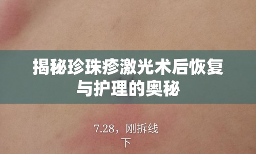 揭秘珍珠疹激光術(shù)后恢復(fù)與護(hù)理的奧秘