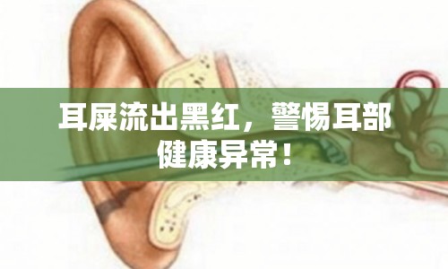 耳屎流出黑紅，警惕耳部健康異常！