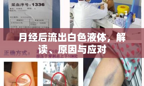 月經(jīng)后流出白色液體，解讀、原因與應(yīng)對