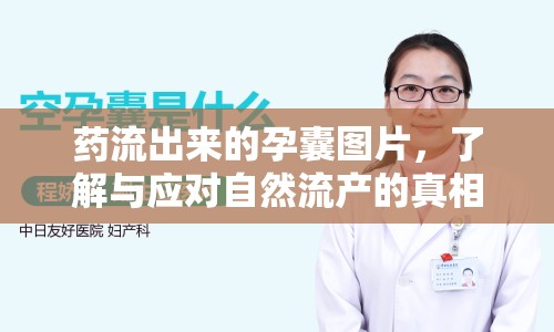 藥流出來的孕囊圖片，了解與應(yīng)對自然流產(chǎn)的真相