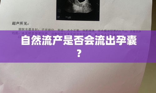 自然流產(chǎn)是否會(huì)流出孕囊？