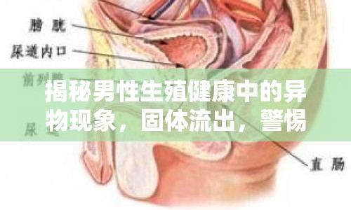 揭秘男性生殖健康中的異物現(xiàn)象，固體流出，警惕健康風(fēng)險(xiǎn)！