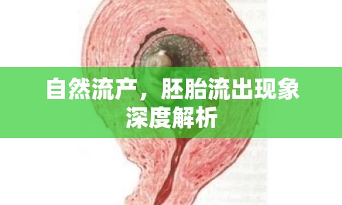 自然流產(chǎn)，胚胎流出現(xiàn)象深度解析