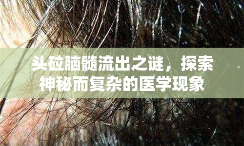 頭砬腦髓流出之謎，探索神秘而復(fù)雜的醫(yī)學(xué)現(xiàn)象