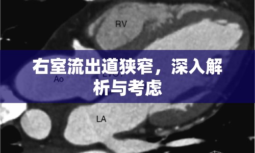 右室流出道狹窄，深入解析與考慮