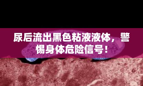尿后流出黑色粘液液體，警惕身體危險(xiǎn)信號(hào)！