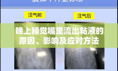 晚上睡覺嘴里流出粘液的原因、影響及應(yīng)對(duì)方法