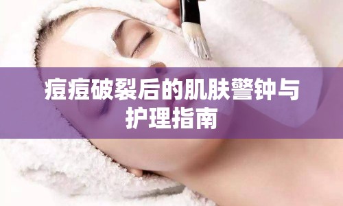 痘痘破裂后的肌膚警鐘與護(hù)理指南
