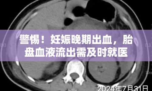 警惕！妊娠晚期出血，胎盤血液流出需及時就醫(yī)