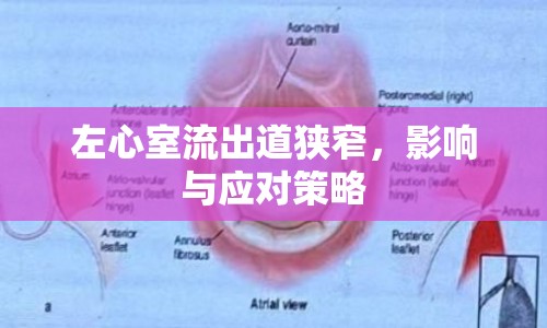 左心室流出道狹窄，影響與應(yīng)對策略