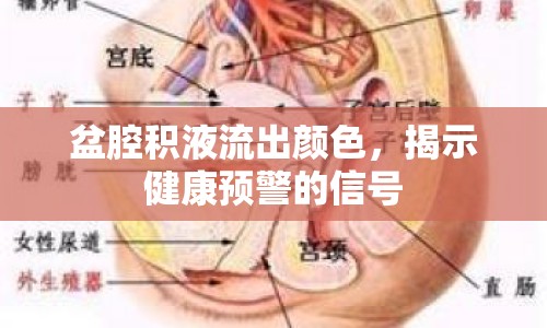 盆腔積液流出顏色，揭示健康預警的信號