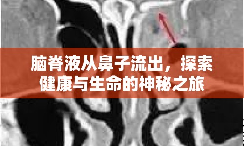 腦脊液從鼻子流出，探索健康與生命的神秘之旅