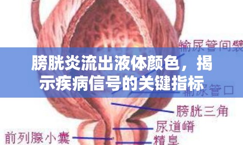 膀胱炎流出液體顏色，揭示疾病信號(hào)的關(guān)鍵指標(biāo)
