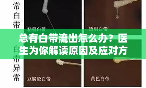 總有白帶流出怎么辦？醫(yī)生為你解讀原因及應(yīng)對方法