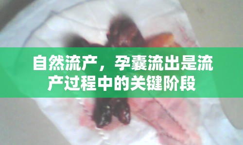 自然流產(chǎn)，孕囊流出是流產(chǎn)過程中的關(guān)鍵階段