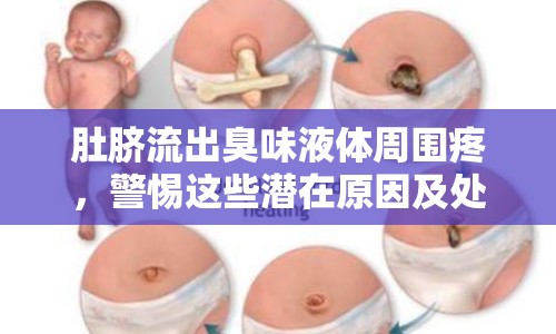 肚臍流出臭味液體周?chē)?，警惕這些潛在原因及處理方法！