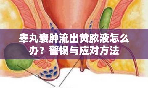 睪丸囊腫流出黃膿液怎么辦？警惕與應對方法