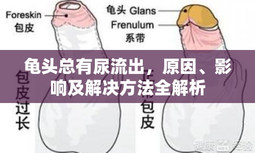 龜頭總有尿流出，原因、影響及解決方法全解析
