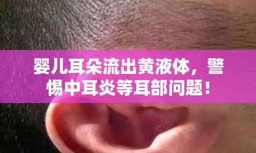 嬰兒耳朵流出黃液體，警惕中耳炎等耳部問題！
