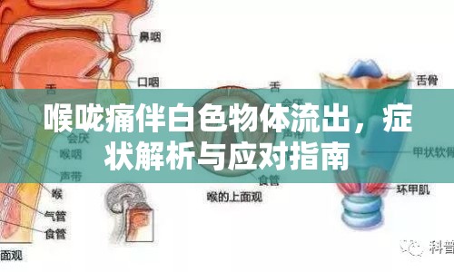 喉嚨痛伴白色物體流出，癥狀解析與應(yīng)對(duì)指南