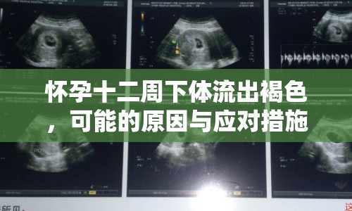 懷孕十二周下體流出褐色，可能的原因與應(yīng)對(duì)措施