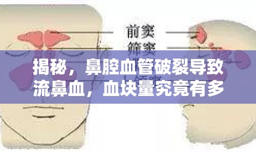 揭秘，鼻腔血管破裂導(dǎo)致流鼻血，血塊量究竟有多少？