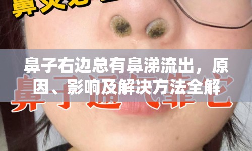 鼻子右邊總有鼻涕流出，原因、影響及解決方法全解析