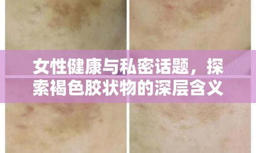 女性健康與私密話題，探索褐色膠狀物的深層含義