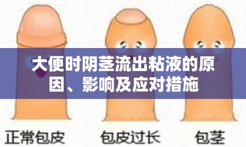大便時(shí)陰莖流出粘液的原因、影響及應(yīng)對(duì)措施