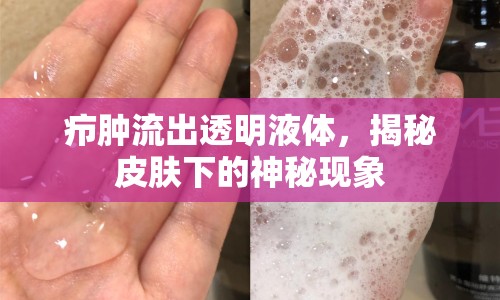 癤腫流出透明液體，揭秘皮膚下的神秘現(xiàn)象
