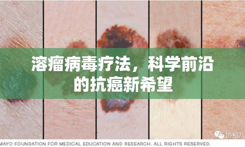 溶瘤病毒療法，科學(xué)前沿的抗癌新希望