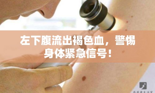 左下腹流出褐色血，警惕身體緊急信號！