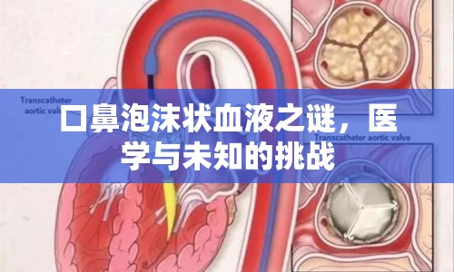 口鼻泡沫狀血液之謎，醫(yī)學(xué)與未知的挑戰(zhàn)