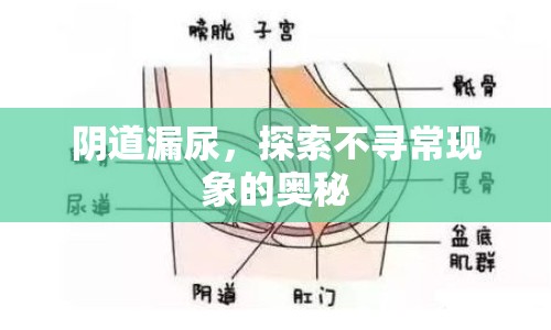陰道漏尿，探索不尋?，F(xiàn)象的奧秘