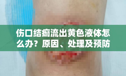 傷口結痂流出黃色液體怎么辦？原因、處理及預防措施全解析