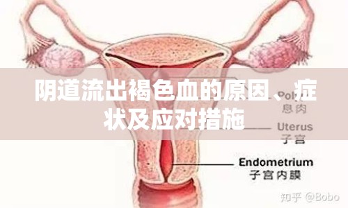 陰道流出褐色血的原因、癥狀及應(yīng)對措施