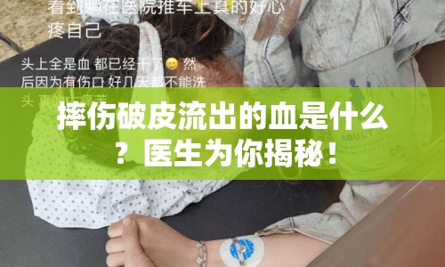 摔傷破皮流出的血是什么？醫(yī)生為你揭秘！