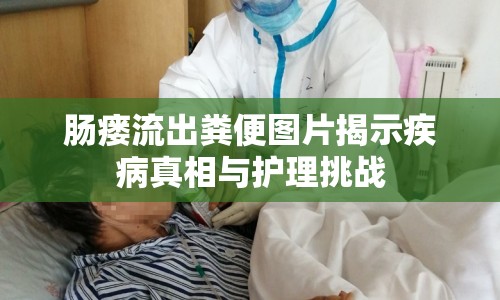 腸瘺流出糞便圖片揭示疾病真相與護理挑戰(zhàn)