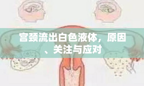 宮頸流出白色液體，原因、關(guān)注與應(yīng)對