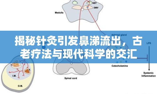 揭秘針灸引發(fā)鼻涕流出，古老療法與現(xiàn)代科學的交匯