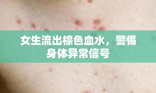 女生流出棕色血水，警惕身體異常信號(hào)