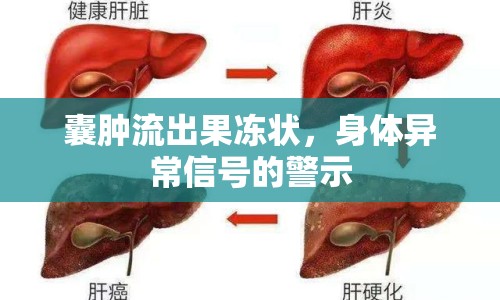 囊腫流出果凍狀，身體異常信號的警示