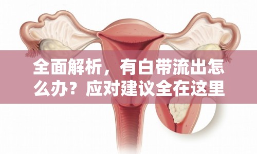全面解析，有白帶流出怎么辦？應(yīng)對(duì)建議全在這里