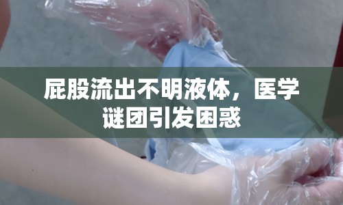 屁股流出不明液體，醫(yī)學謎團引發(fā)困惑