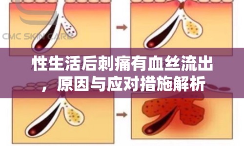 性生活后刺痛有血絲流出，原因與應(yīng)對措施解析