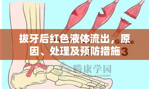 拔牙后紅色液體流出，原因、處理及預(yù)防措施