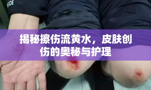 揭秘擦傷流黃水，皮膚創(chuàng)傷的奧秘與護(hù)理