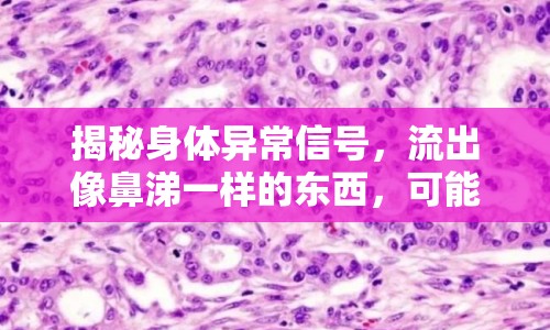 揭秘身體異常信號(hào)，流出像鼻涕一樣的東西，可能是健康警示！