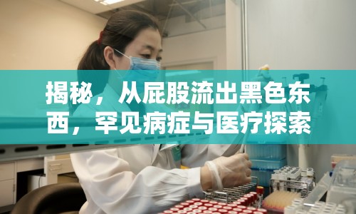 揭秘，從屁股流出黑色東西，罕見病癥與醫(yī)療探索